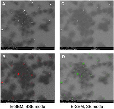 Mechanism and Prevention of Titanium Particle-Induced Inflammation and Osteolysis